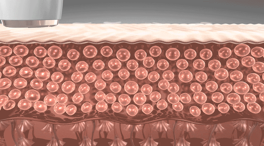 3d28343f1084eb738a523d6121c6907c_1767093770_4054.gif 3d28343f1084eb738a523d6121c6907c_1767093770_4054.gif